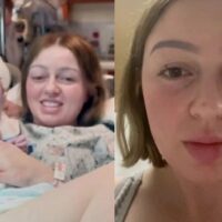 Grávida de 23 anos vai à hospital dar à luz e tem olho saltado após colocar muita força; médico se assustou